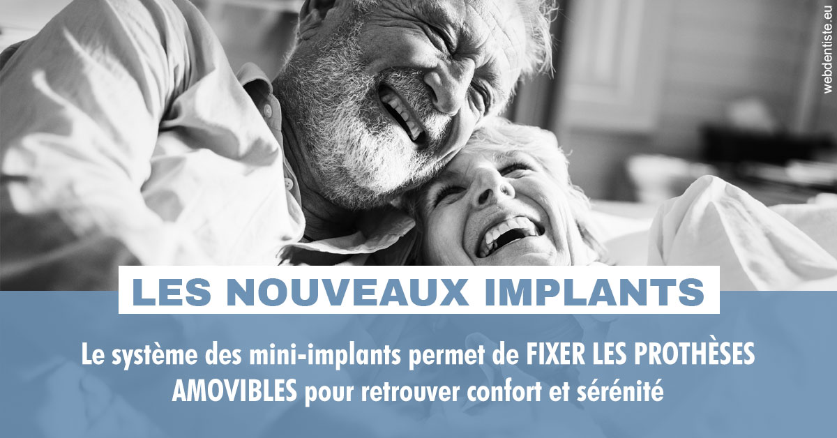 https://dr-opoka-jm.chirurgiens-dentistes.fr/Les nouveaux implants 2