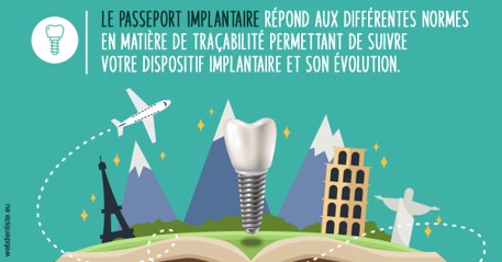 https://dr-opoka-jm.chirurgiens-dentistes.fr/Le passeport implantaire
