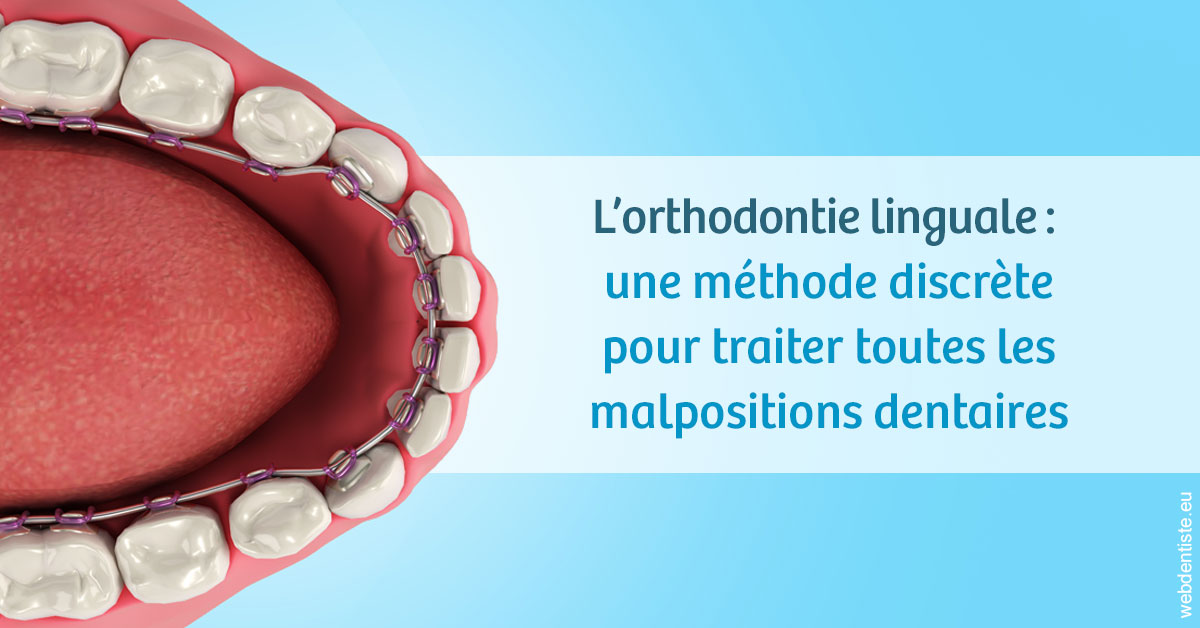https://dr-opoka-jm.chirurgiens-dentistes.fr/L'orthodontie linguale 1