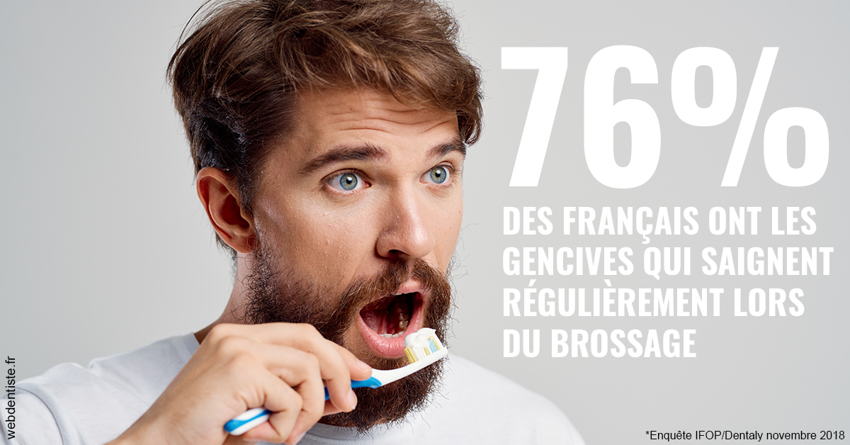 https://dr-opoka-jm.chirurgiens-dentistes.fr/76% des Français 2