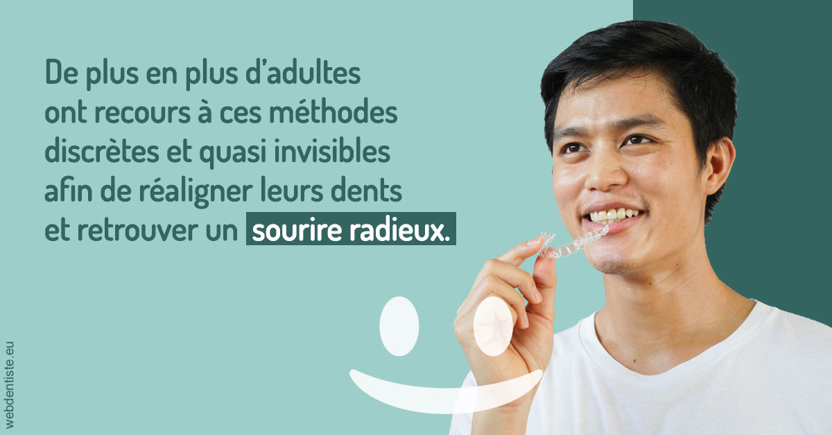https://dr-opoka-jm.chirurgiens-dentistes.fr/Gouttières sourire radieux 2