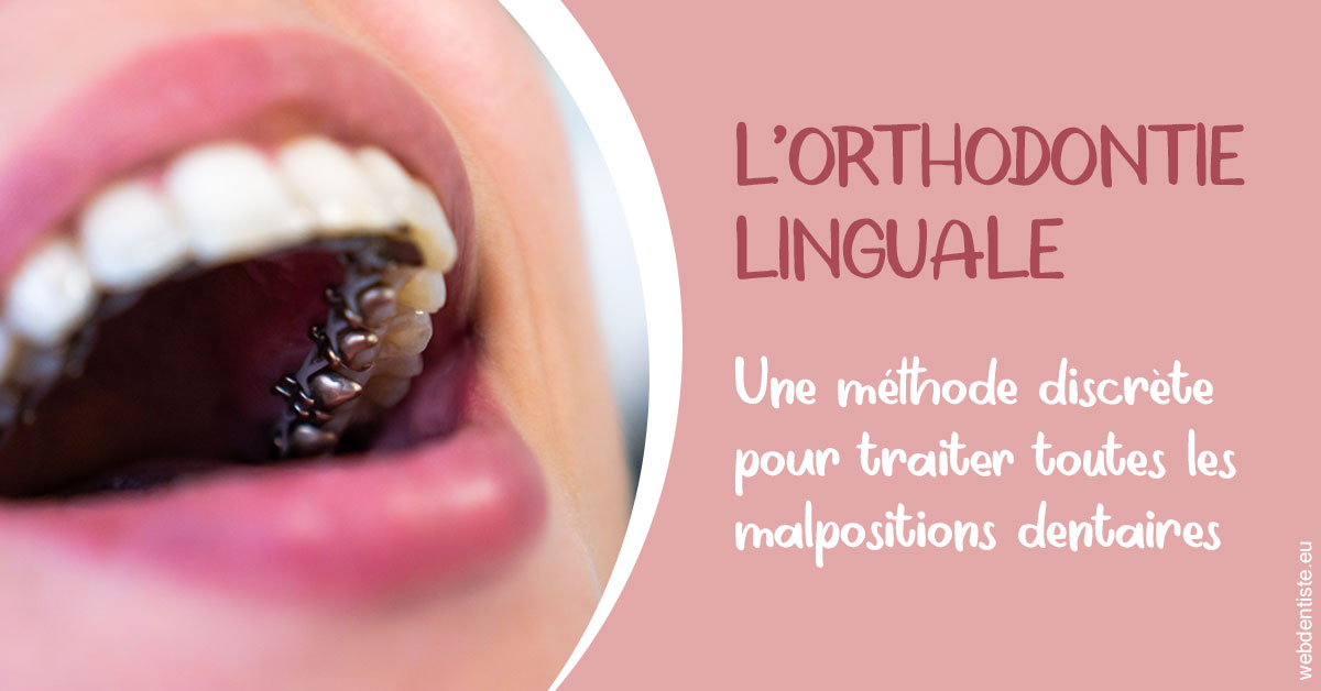 https://dr-opoka-jm.chirurgiens-dentistes.fr/L'orthodontie linguale 2
