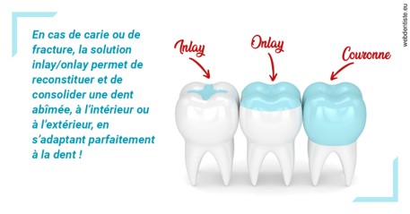 https://dr-opoka-jm.chirurgiens-dentistes.fr/L'INLAY ou l'ONLAY