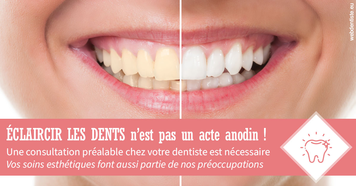 https://dr-opoka-jm.chirurgiens-dentistes.fr/Eclaircir les dents 1