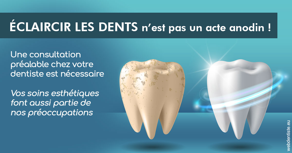 https://dr-opoka-jm.chirurgiens-dentistes.fr/Eclaircir les dents 2