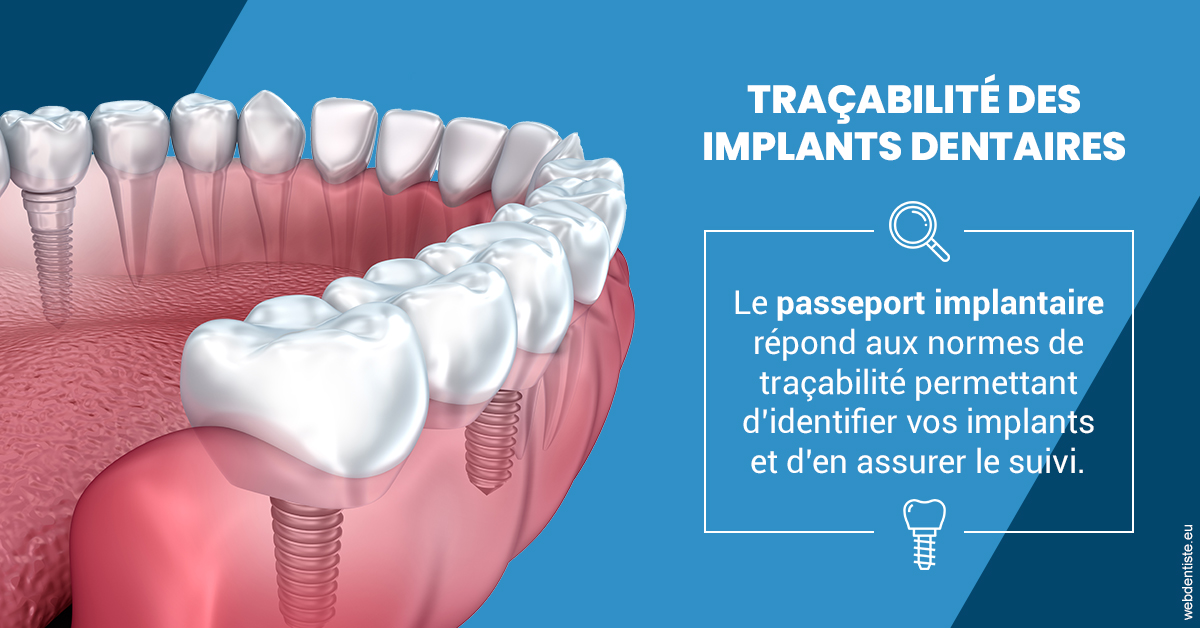 https://dr-opoka-jm.chirurgiens-dentistes.fr/T2 2023 - Traçabilité des implants 1