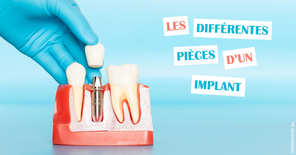 https://dr-opoka-jm.chirurgiens-dentistes.fr/Les différentes pièces d’un implant 2