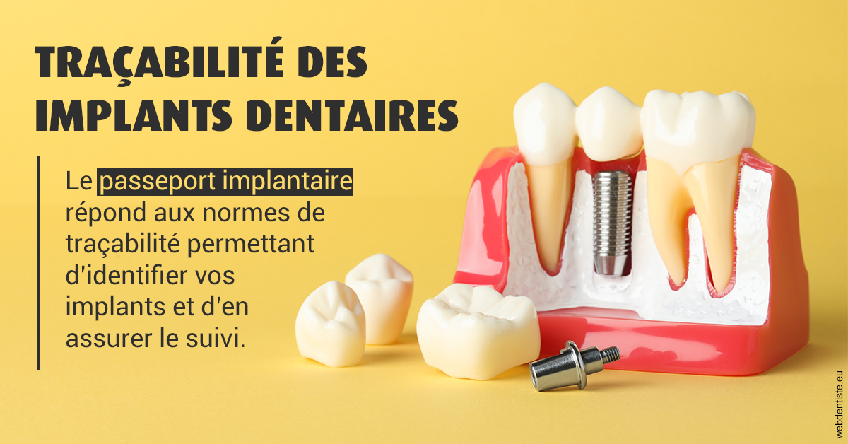 https://dr-opoka-jm.chirurgiens-dentistes.fr/T2 2023 - Traçabilité des implants 2