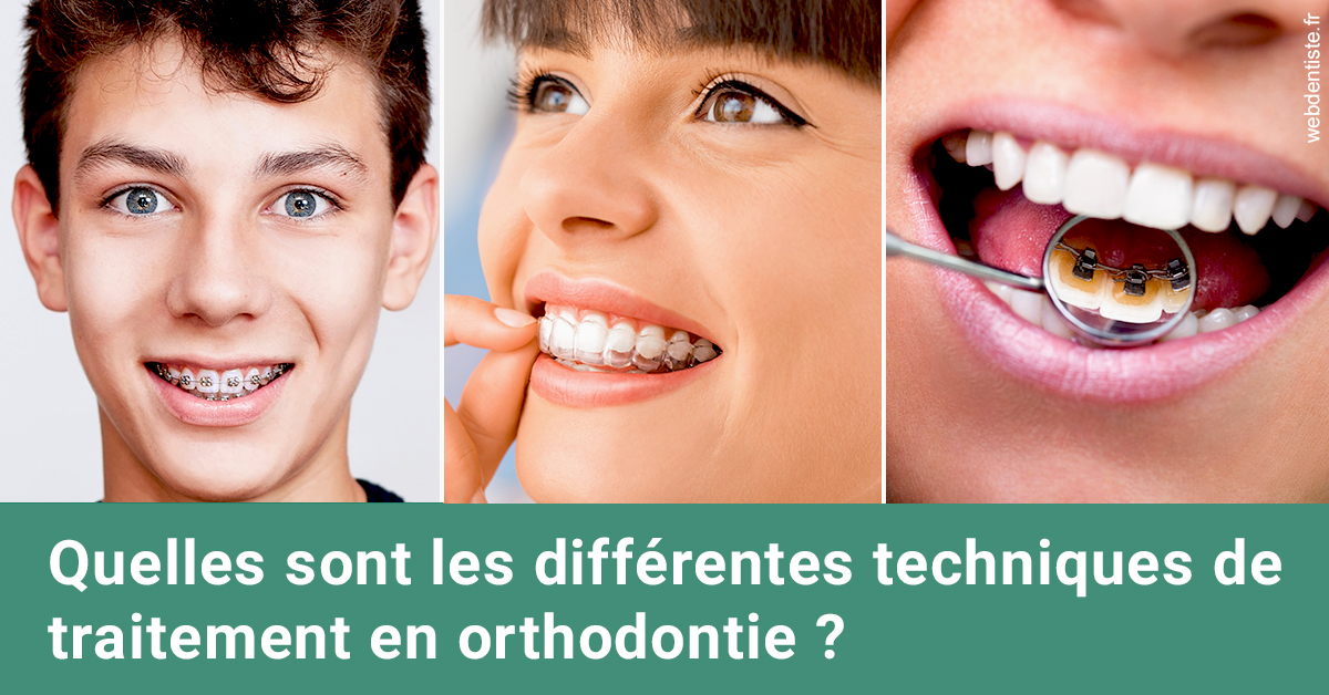 https://dr-opoka-jm.chirurgiens-dentistes.fr/Les différentes techniques de traitement 2