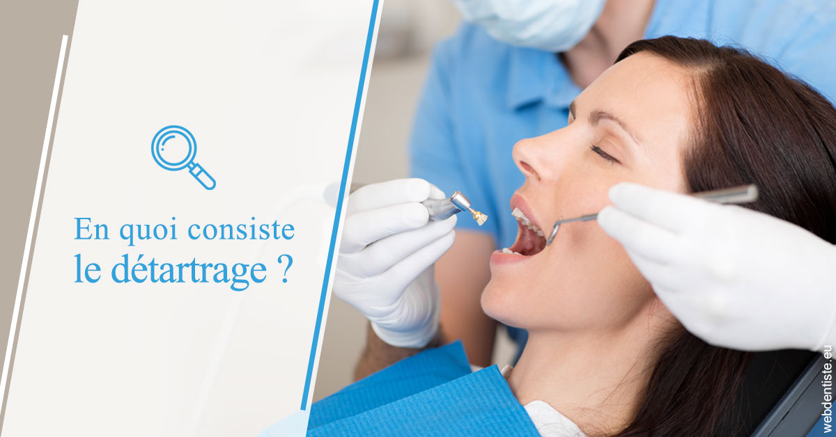https://dr-opoka-jm.chirurgiens-dentistes.fr/En quoi consiste le détartrage